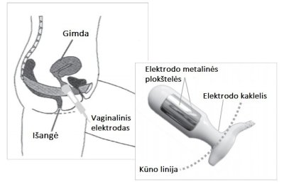 Iegurņa pamatnes stimulācijas ierīce NeuroTrac CONTINENCE
