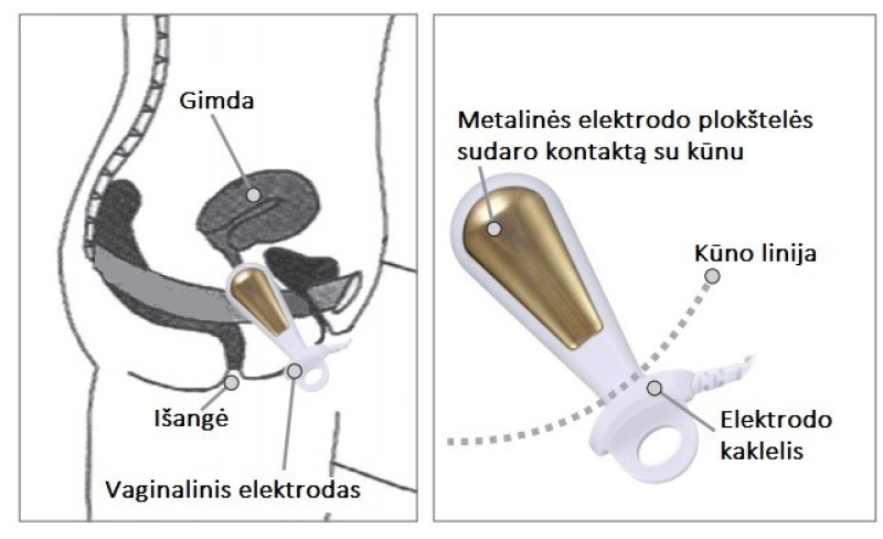 Dzeltenās elektrodes vaginālajai elektriskajai stimulācijai vai EMG stimulācijai