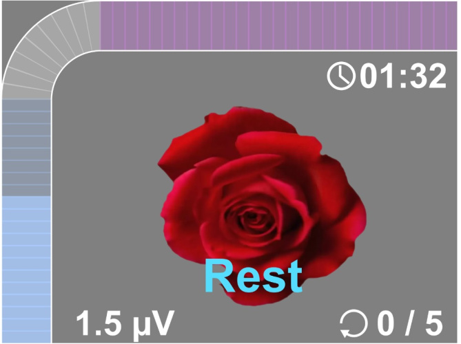Elektromiogrāfijas aparāts NeuroTrac MyoPlus Pro EMG (ar elektrostimulāciju)